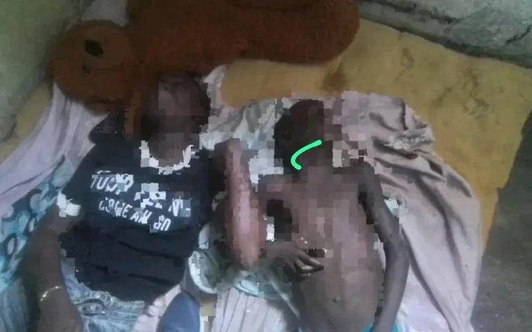 Adolescentes em Malanje morrem por inalação de monóxido de carbono.