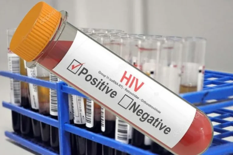 Mais de 70% de jovens mulheres em Angola vivem com o HIV-SIDA