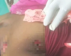 Mulher de 53 anos morre após ser atingida por disparos de arma de fogo no Tunga-Ngó